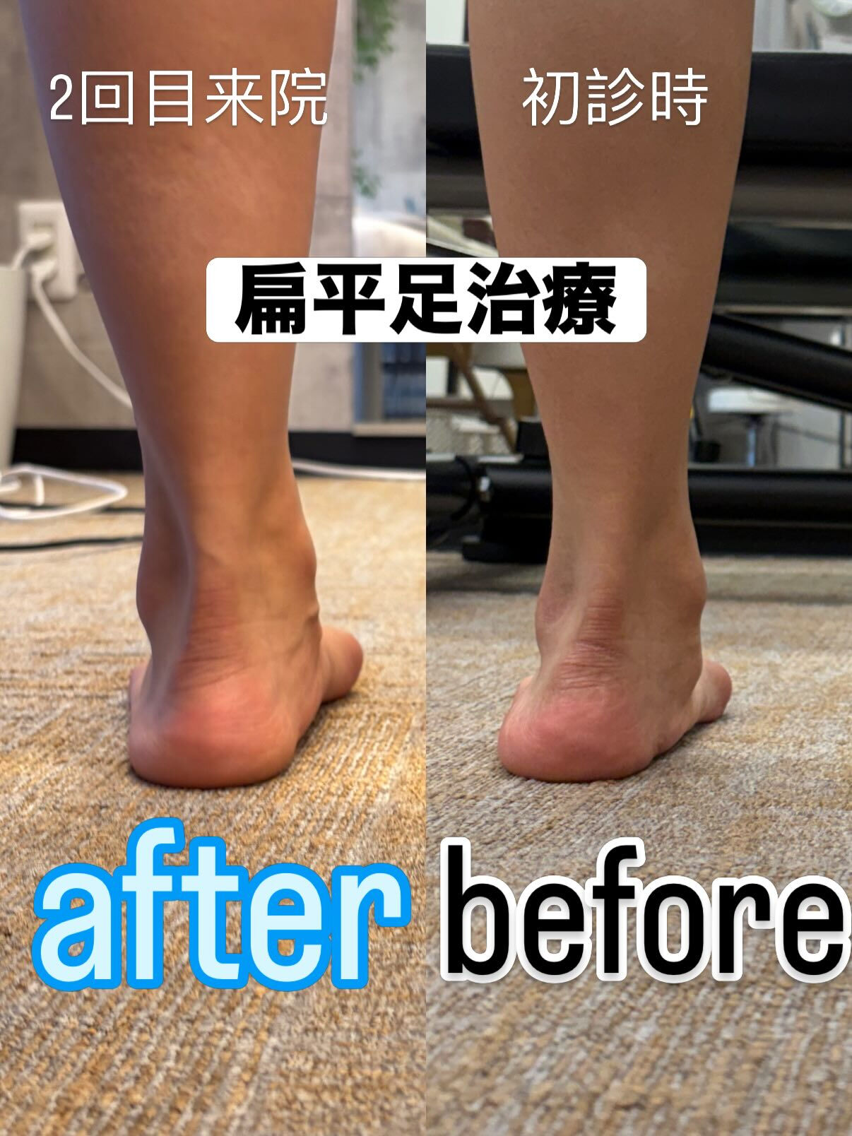 【お客様before/after】