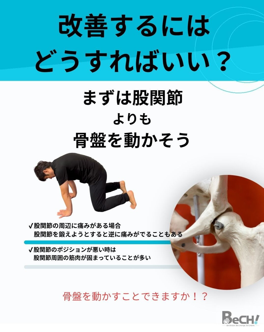 【股関節がつまる人ストレッチでは治らないかも】